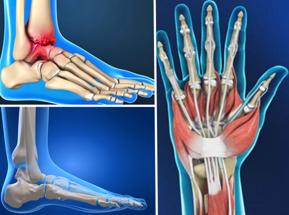 Hand, Foot and Ankle Surgeries