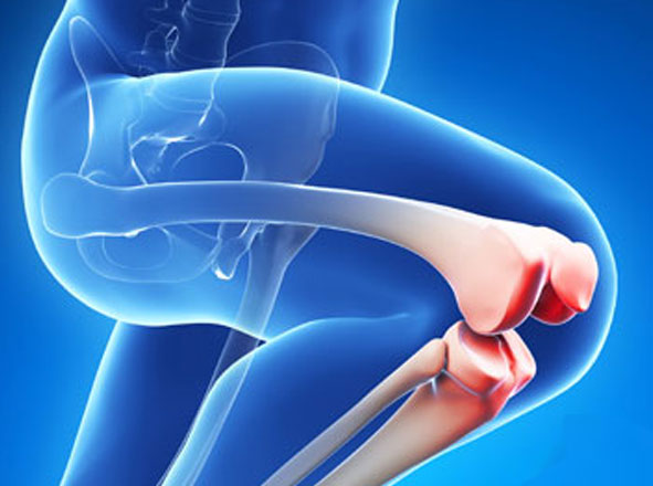 Revision Joint Replacement Surgeries